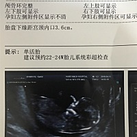 Nt回来 折腾了四次才拍成功 胎心率是不是太高了啊 有会看照片辨性别的吗 😄
