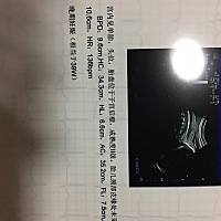 都说从B超跟肚子能看出来？