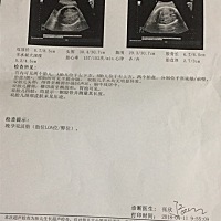 希望你俩乖乖的在妈妈的肚子住到三十七周平安出生，妈妈辛苦一点也无所谓，只希望你俩都平安健康！俩宝...