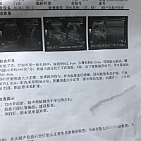 怎么看是男的是女，看不出啊，才13周