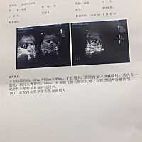 没结婚 男朋友对我很不好 吵架是有的 但是 大嫂二嫂的孩子公婆都不带的 可是不带的话老公又没有能力给我...