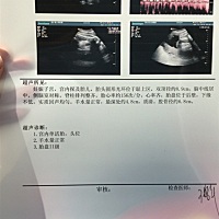 有会看b超单的吗？这医生没医德，问的做b超医生孩子小，问产科医生孩子大，说我体重超标，产科医生又给...