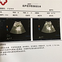 为什么可能是俩个胎芽暂时看见一个胎心.7周.4天