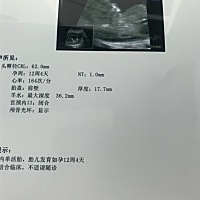 帮忙看看男宝还是女宝