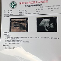 一声叫我半个月再去做检查，没有太呀，激素低，宝妈们这半个月该注意什么？