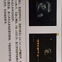 能看出是男宝还是女宝吗