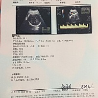 各位姐妹们能看出来男宝女宝么、35➕5、