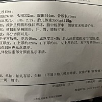 有懂的人看看是男宝女宝吗 孕37周 2