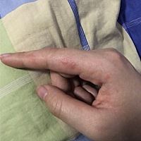 怀孕三个月，最近手就像冬天冻手一样有红，是咋回事啊？