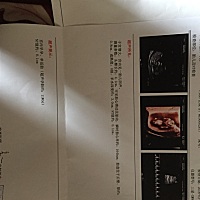 nt看看是男是女？