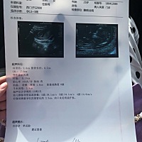 各位看看男孩女孩？