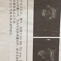 帮忙看看是男是女，挺好奇的 8周的B超