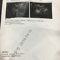 亲们，七周的B超，我怎么看B超图能看到他的头和手脚了，是我看错了吗🤓 这周在打孕酮，希望孕酮和hcg...