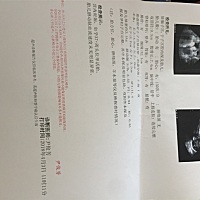 帮忙看看 是男宝还是女宝   怎么看的