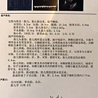 好想知道是男还是女😣