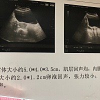 今天冒雨去了医院，还有意外惊喜，有一个即将成熟的卵泡😍了，希望能顺利排卵，然后……期待好孕～