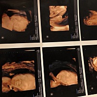 做了四维彩超，看图片上宝宝的样子真是越看越喜欢，只有我自己觉得他很可爱吗？