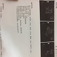 能帮我看一下是男宝还是女宝吗？谢谢了