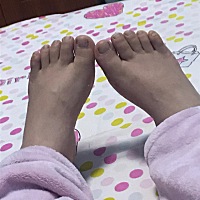 突然就手 脚都肿了😂 各位宝妈可有缓解之法