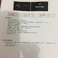 前天做的B超，34周➕，宝宝比预产期小了半个多月呦