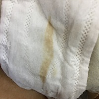 谁跟我一样，这是大姨妈还是什么