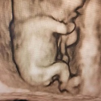 怀孕13周，看不清是不是儿子，有点着急。