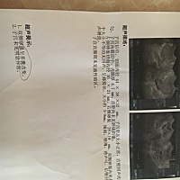 准备要宝宝、检查出来双侧卵巢多囊改变。亲亲、能告诉我有什么办法吗？这种是内分泌失调吗？