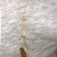 想问问大家，怀孕40多天，流这样的血3天了，会不会是流产了？这个量只是下午的，上午也有不少