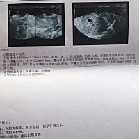 刚刚检查出怀孕了，天天都觉得很累，很困！吃饱就睡！各位帮忙看一下是男孩还是女孩！谢谢🙏！