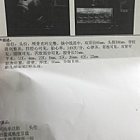 每次一来做检查就心惊胆战 今天检查羊水只有52 医生又建议我住院 😭 我不想住院