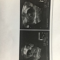 大家帮忙看看是男宝女宝