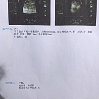 NT检查通过，哪位亲给看看男宝还是女宝，好奇