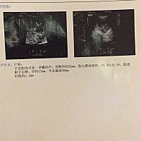 哪位亲给看看是男宝还是女宝