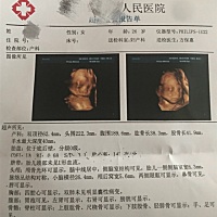 能看出男宝还是女宝吗？很好奇^_^