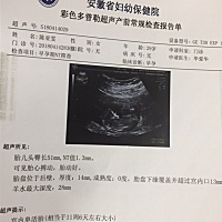 前两天做的nt，医生说胎盘有点低，让我多休息，有没有跟我情况一样的宝妈呀，有点担心