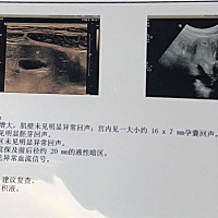 有没有会看的，帮忙看一下宝宝的状态，谢谢