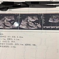 亲爱的们，昨天刚刚去医院照的12周的彩超，第一次见我宝宝，可激动了。嘿嘿😁。能看出是男宝宝还是女...