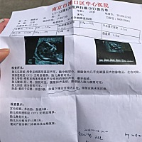 新鲜出炉的nt报告