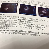 怀孕34周，体重一直都是处于谁能偏轻，营养不良，也吃不下东西，好担心胎儿吸收不到营养，去医院检查B超...