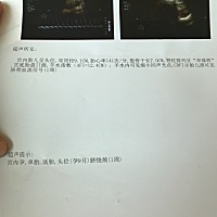 宝宝不知是否健康 求解答