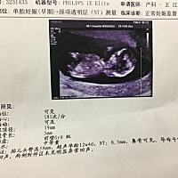 今天照了B超，貌似没有看到小jj