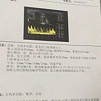 麻烦妈妈们帮我看看多重谢谢