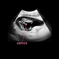 告诉大家怎么在做四维时，自己看出宝宝的性别。首先，要选择一间可以医生一边照，你自己可以一边看电脑...