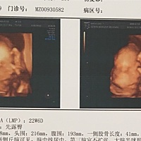 四维回来婆婆要看孩子照片，看完说宝宝秀顶