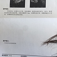 亲们这没啥问题吧？等了半天医生还在排队、