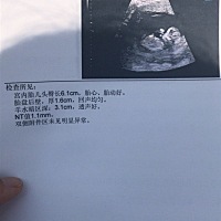 小小的，心都化了😁