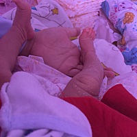 婴孩腿都这样吗？你们家宝宝也这样吗