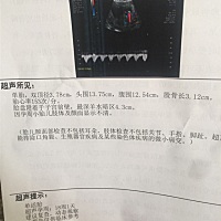 16周多。今天做🉐彩超。有宝妈能看懂男孩女孩吗？谢谢