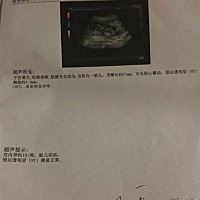 请问能看出男女吗，三胎了压力山大呀！