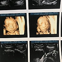 看得出来男女吗